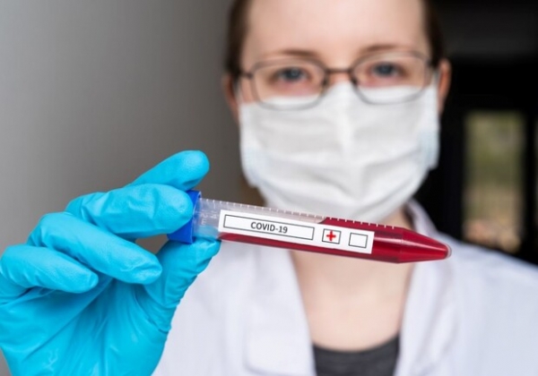 Все больше заболевших: какая статистика Covid-19 в Одесской области сегодня