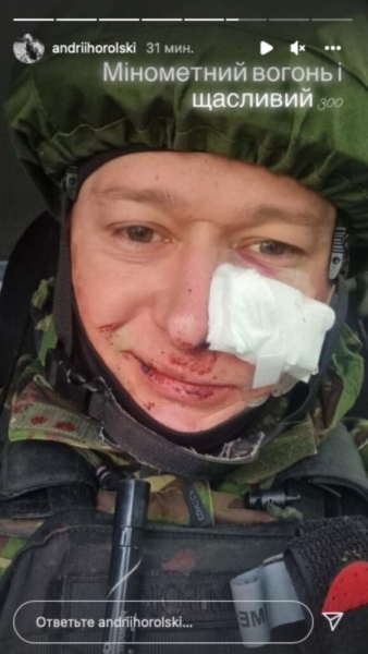 Лидер «Бумбокса» Андрей Хлывнюк получил осколочное ранение
